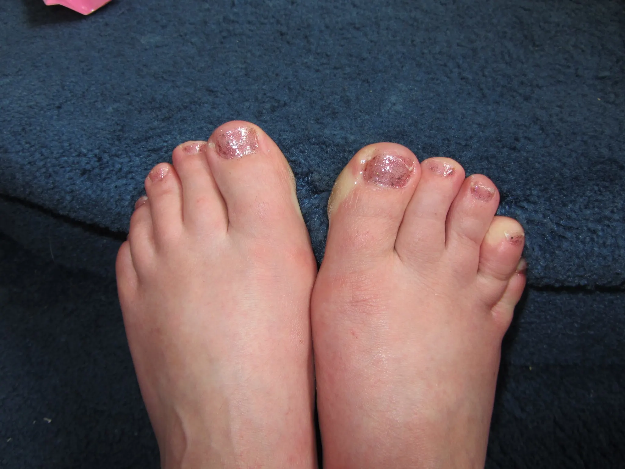 Toes are us! Superdrug cbias pedicure