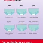 The image is showing a chart that explains the different types of vaginal discharge and what they mean in terms of health.